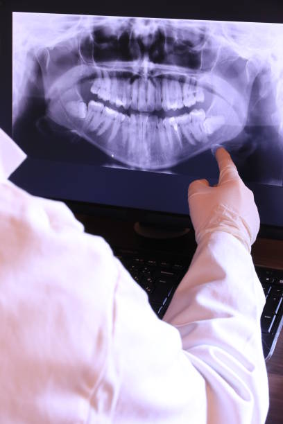 Best Chipped Tooth Repair Near Me  in Jacksboro, TN