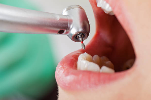 Best Affordable Emergency Dental Care  in Jacksboro, TN
